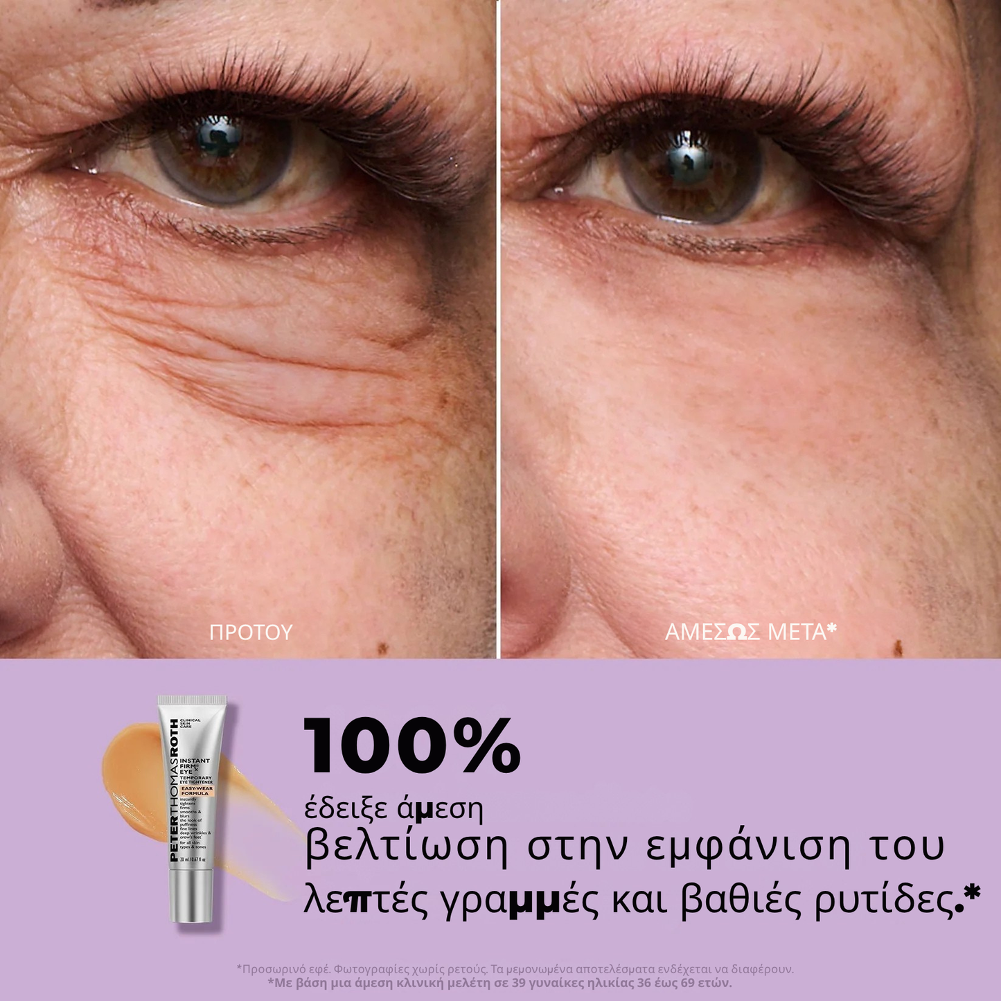 Instant FIRMx Eye Προσωρινό σφικτικό ματιών Εύκολη φόρμουλα εφαρμογής