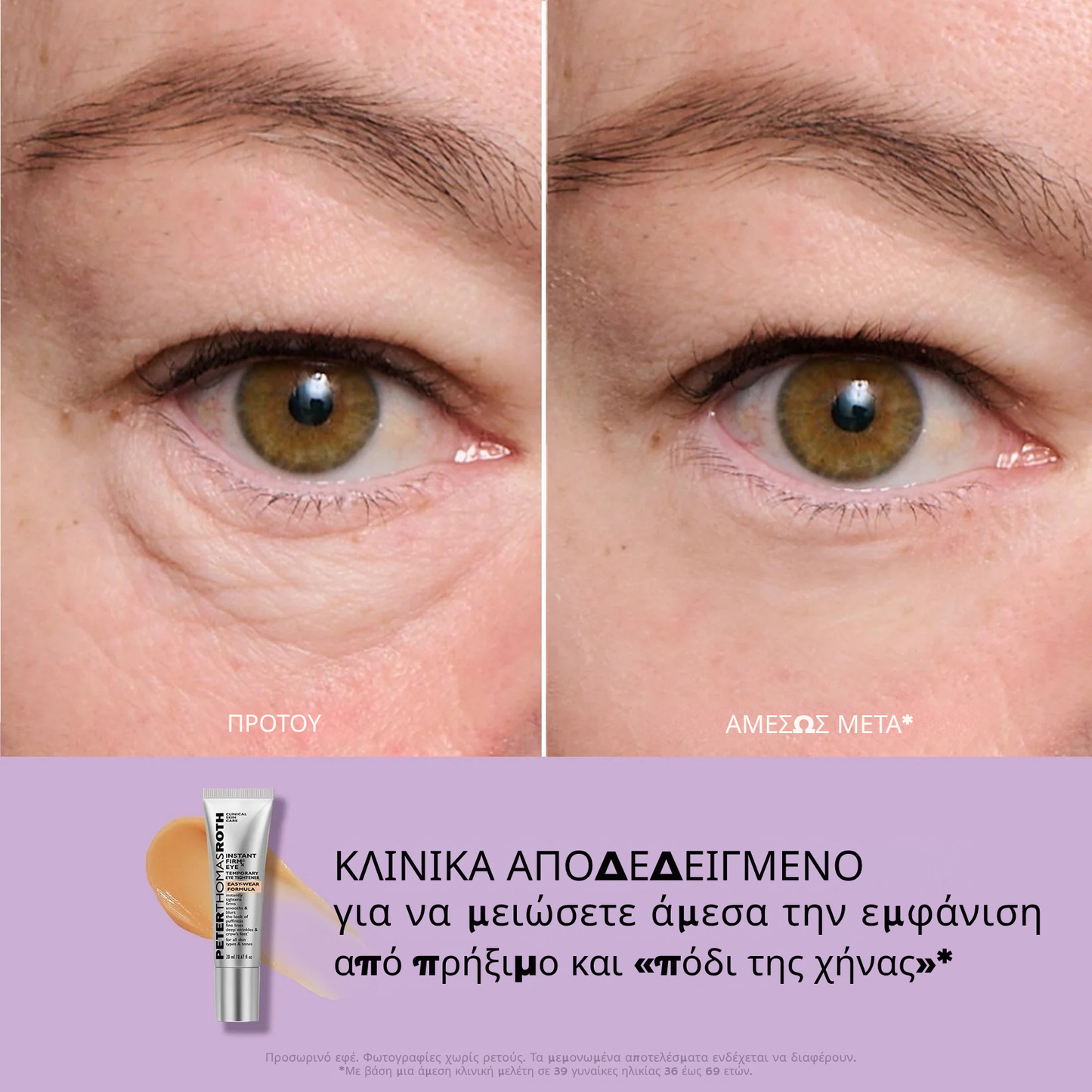 Instant FIRMx Eye Προσωρινό σφικτικό ματιών Εύκολη φόρμουλα εφαρμογής