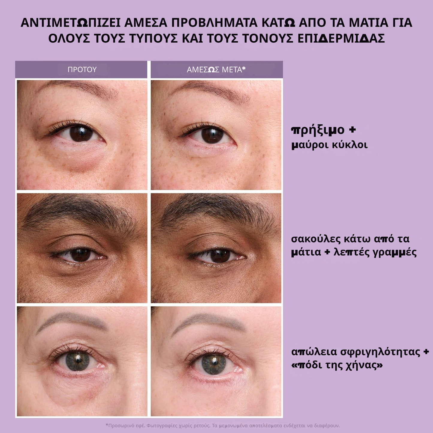 Instant FIRMx Eye Προσωρινό σφικτικό ματιών Εύκολη φόρμουλα εφαρμογής