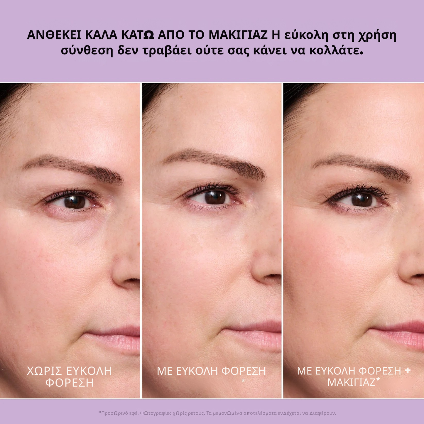Instant FIRMx Eye Προσωρινό σφικτικό ματιών Εύκολη φόρμουλα εφαρμογής