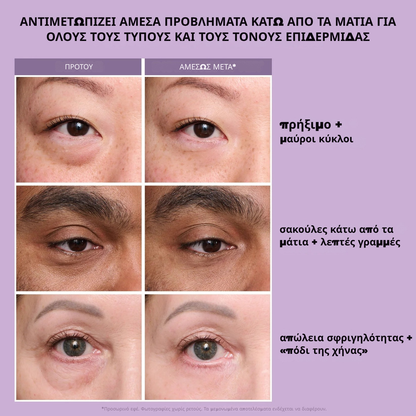 Instant FIRMx Eye Προσωρινό σφικτικό ματιών Εύκολη φόρμουλα εφαρμογής